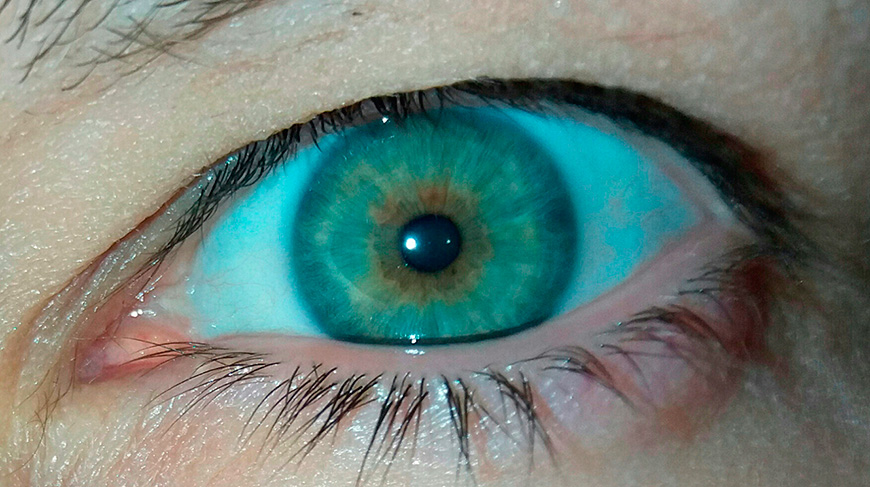 iridologia